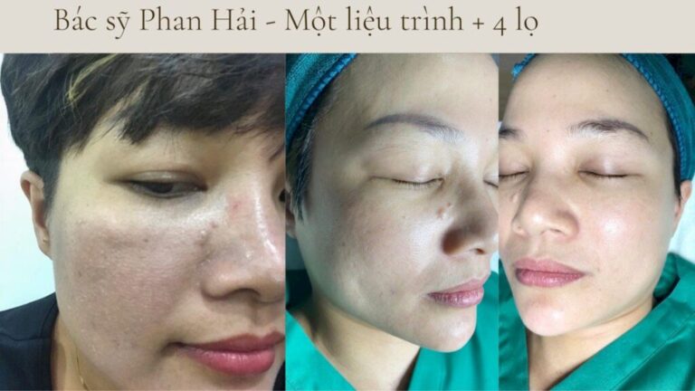 Bác sỹ da liễu Phan Hải lựa chọn Nước uống đẹp da AGE20S collagen peptide cho bản thân và khách hàng