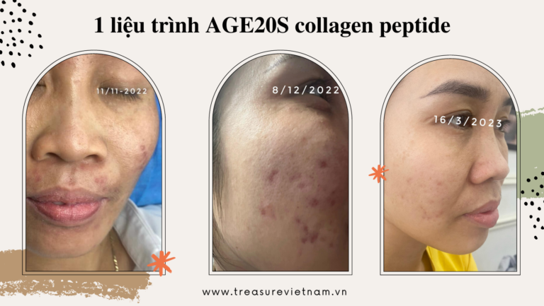 Chỉ với một liệu trình AGE20S Collagen Peptide, hiệu quả bất ngờ